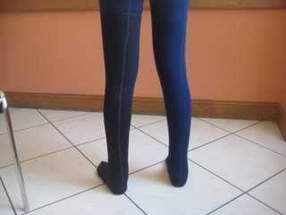 photo de deux jambes dont une avec lymphœdème et solution de compression pour traitement