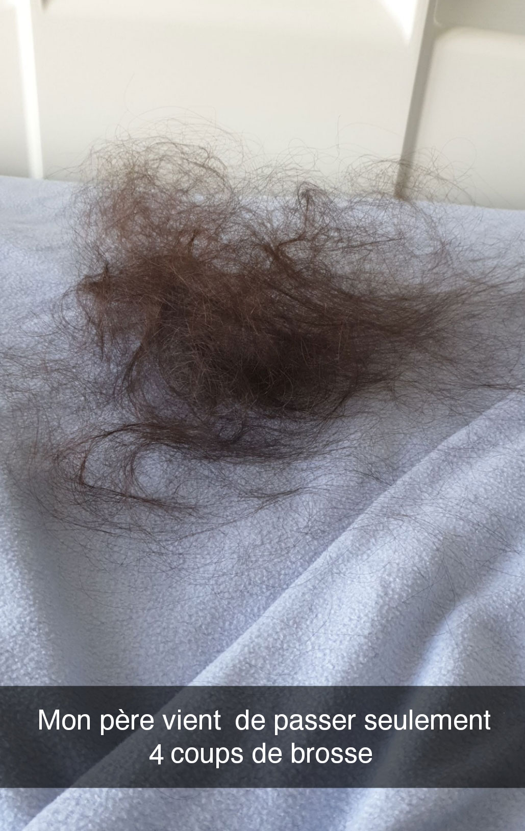 photo de mèches de cheveux tombées pendant le cancer de Carla, une ado